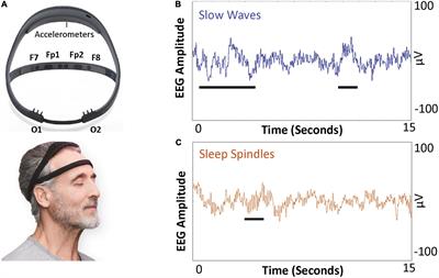 Correlating electroconvulsive therapy response to electroencephalographic markers: Study protocol